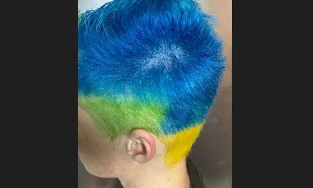 Δίωξη σε κάτοικο της Μόσχας που είχε βάψει τα μαλλιά του μπλε και κίτρινα γιατί «συμβόλιζαν» την Ουκρανία